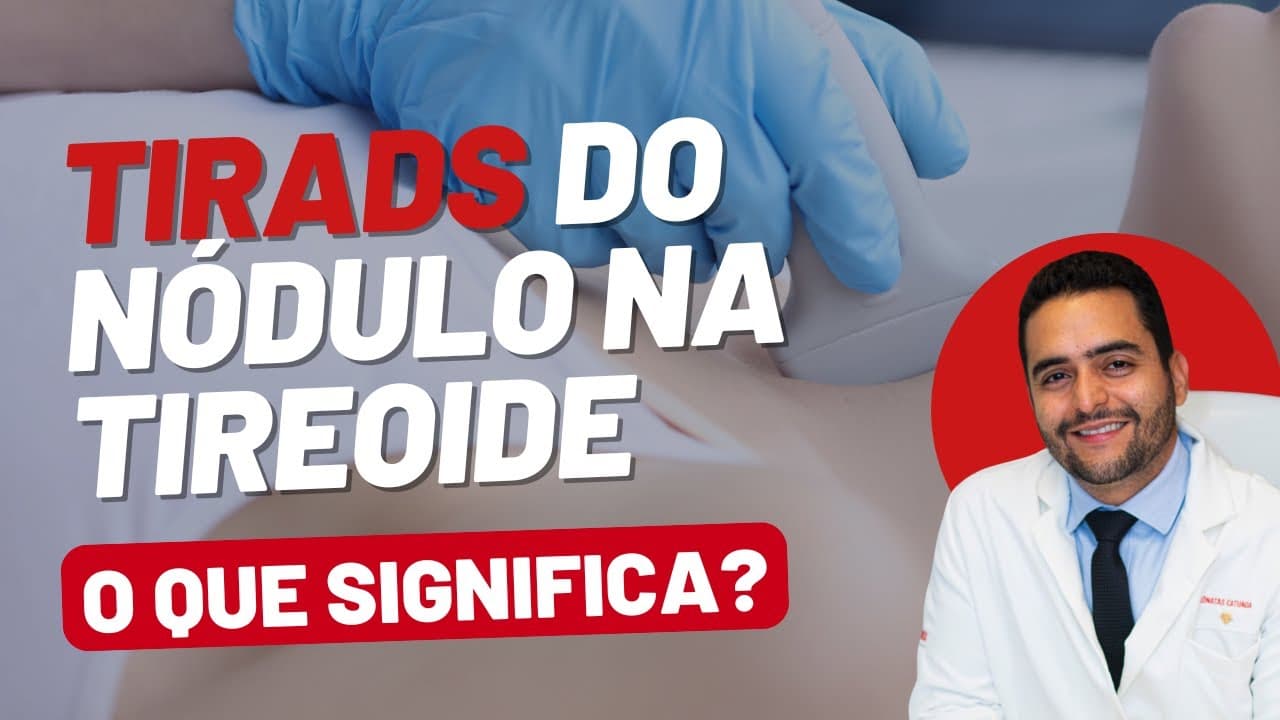 TIRADS: Entenda a Classificação dos Nódulos na Tireoide e o que Significa para Sua Saúde!