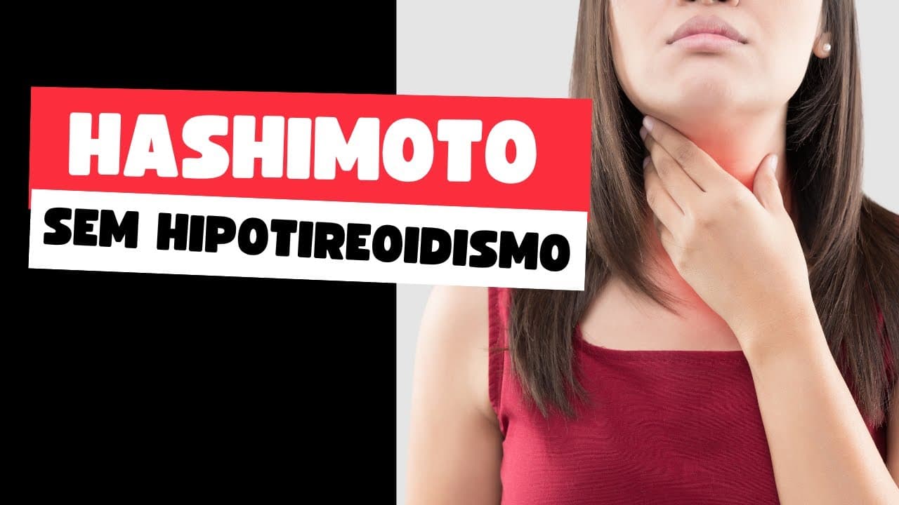 Tireoidite de Hashimoto sem hipotireoidismo - o que fazer?
