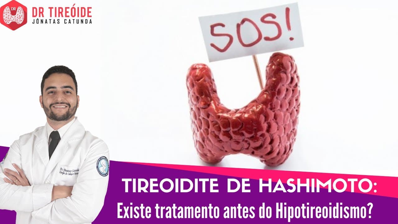 Tireoidite de Hashimoto tratamento