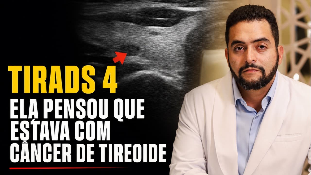 Nódulo TIRADS 4 na tireoide é câncer? O que o laudo não diz