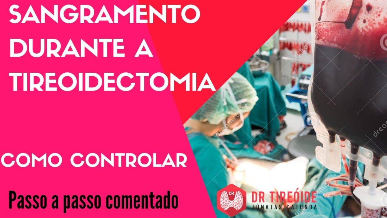Sangramento durante a tireoidectomia - controlando hemorragias - Cirurgia | Dr Jônatas Catunda