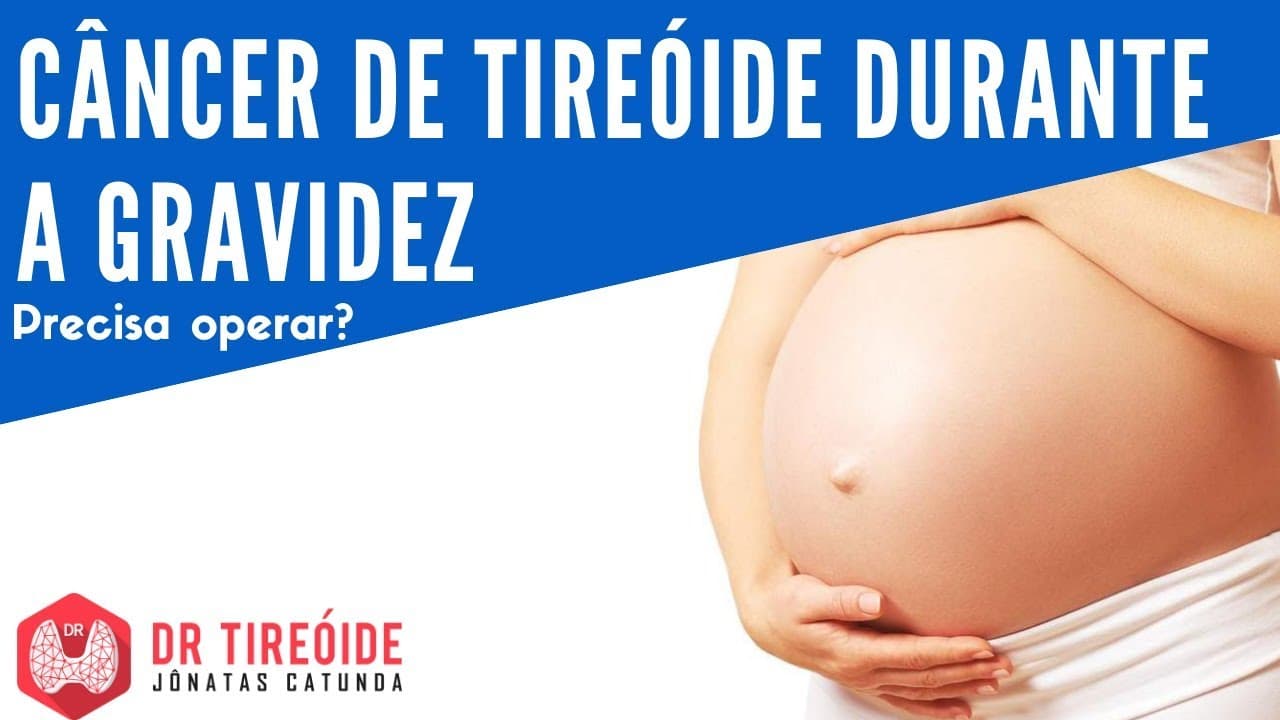 Câncer de tireóide durante a gravidez - Precisa operar? - Dr Tireóide Responde