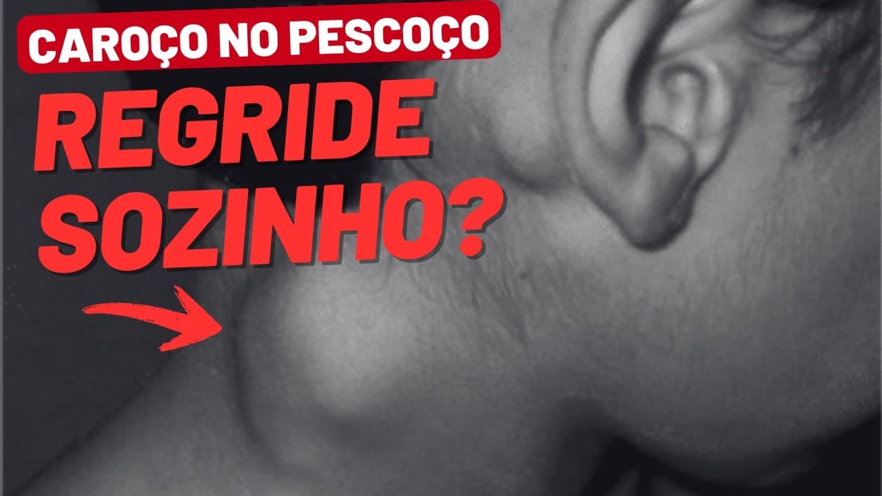 Caroço no pescoço: quanto tempo demora para regredir?