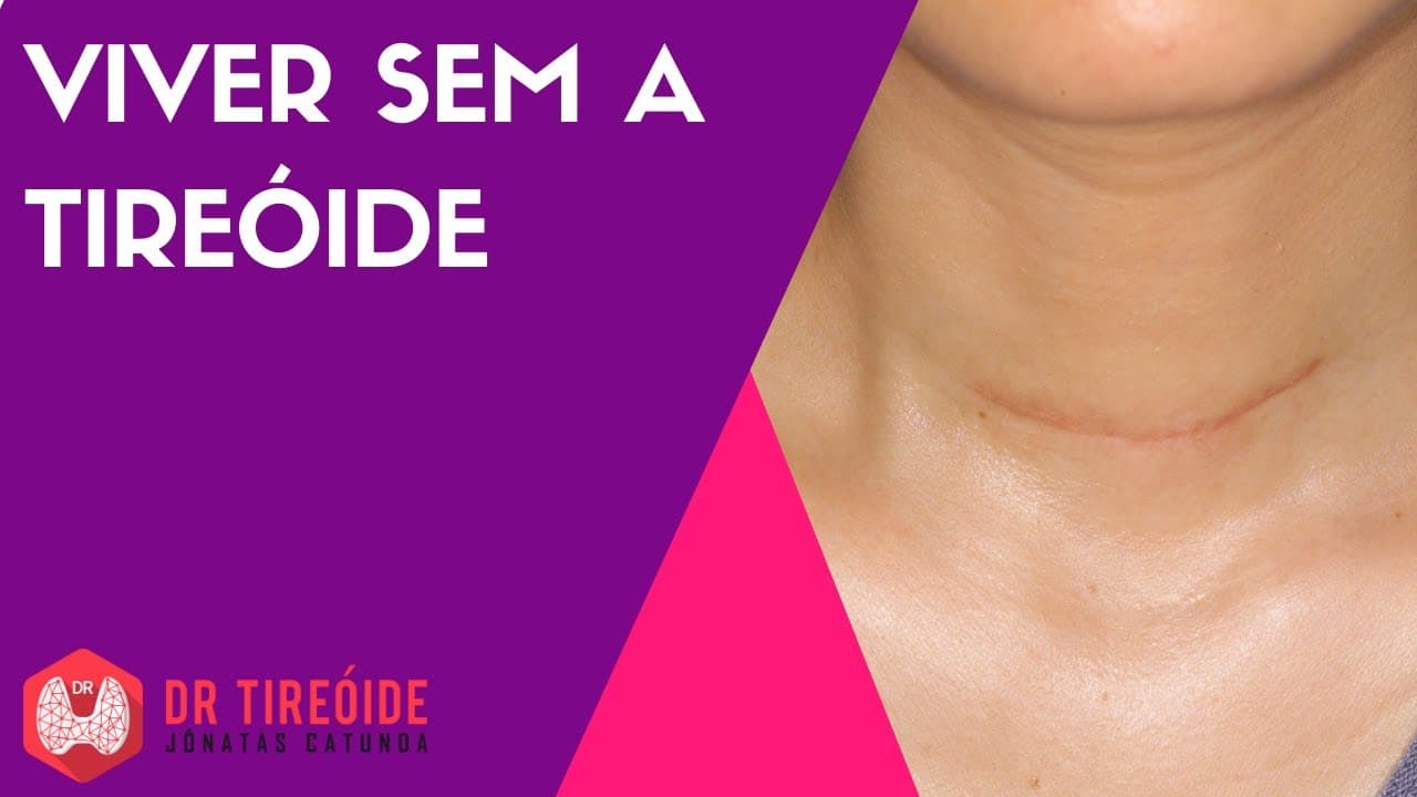 Viver sem a tireóide
