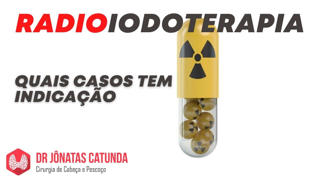 Radioiodoterapia - quais casos tem indicação desse tratamento?