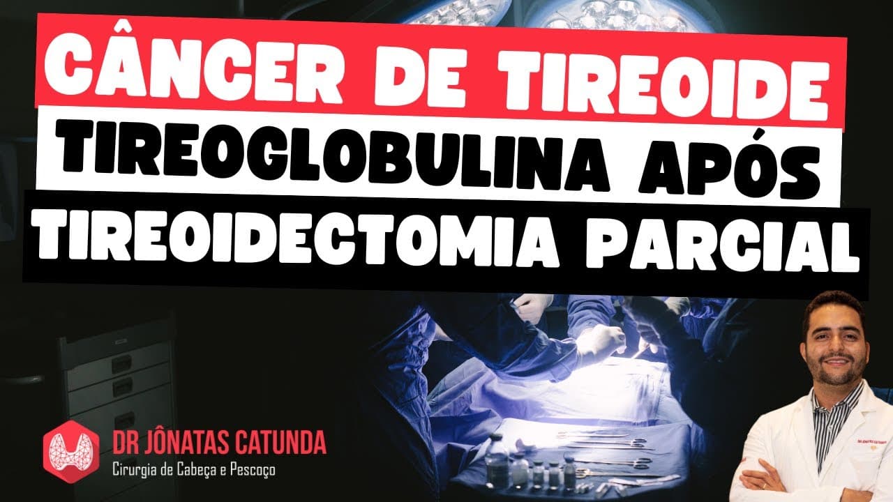 Tireoglobulina na tireoidectomia parcial para o câncer de tireoide - confiável?