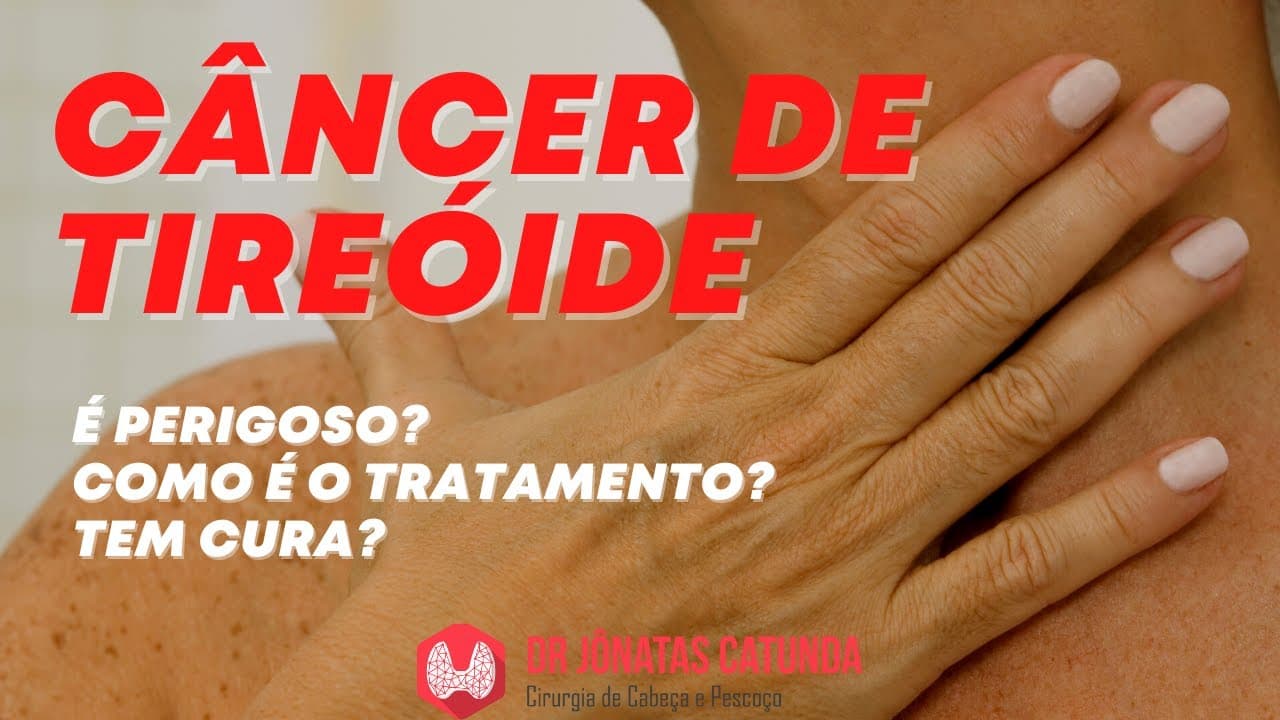 Câncer de tireóide - é perigoso? como é o tratamento? tem cura?