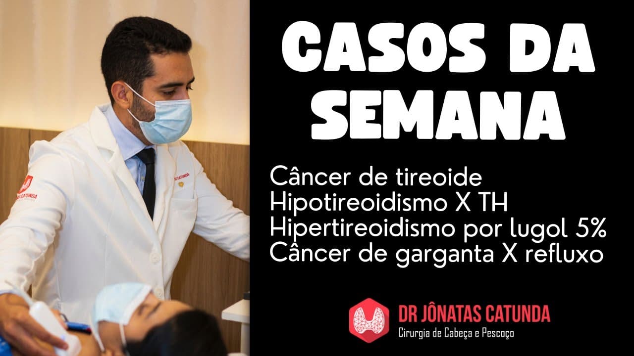 Casos da semana - Câncer de tireoide, cansaço por hipotireoidismo? hipertireoidismo