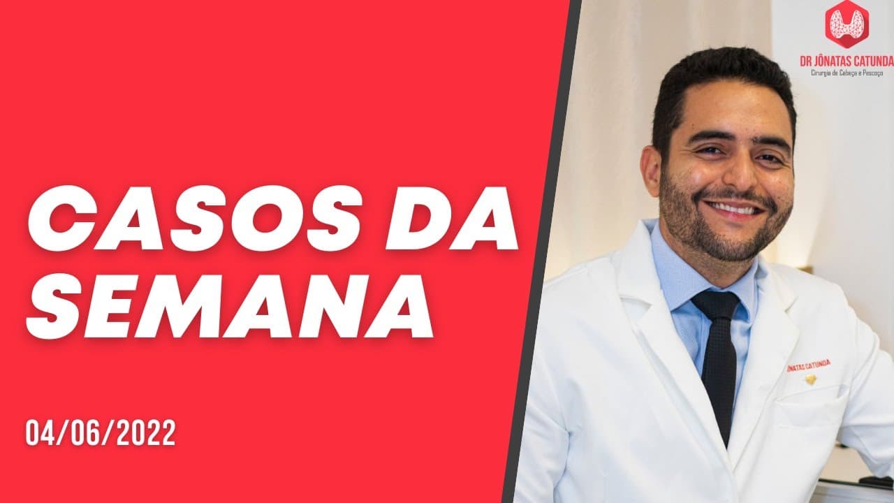 Casos da semana - Qualidade de vida, linfonodos, Hipertireoidismo, cancer de tireoide, tireoidite