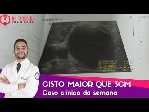 Cisto na tireóide volumoso, maior que 3cm - Caso clínico da semana