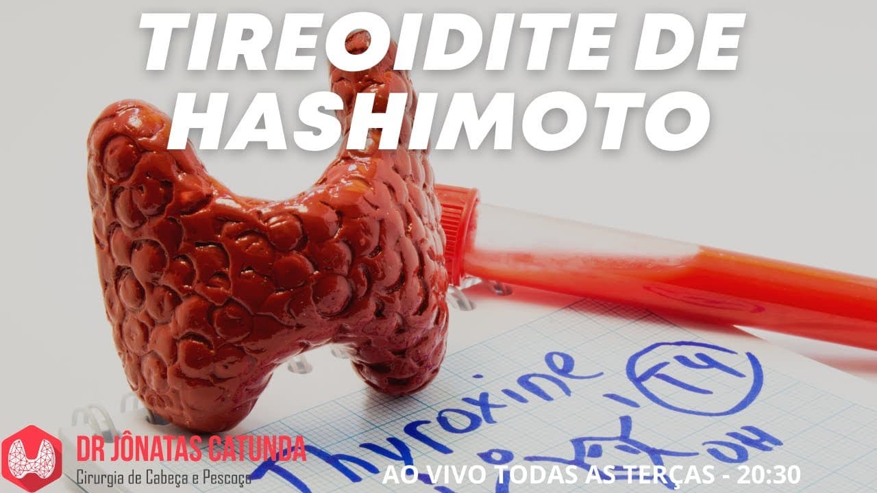 Tireoidite de Hashimoto - o que é, sintomas, tratamento, consequências