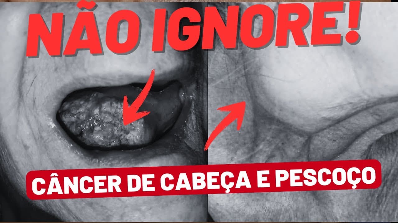 5 Sinais de Alerta no Pescoço e na Boca que Você NÃO Pode Ignorar!