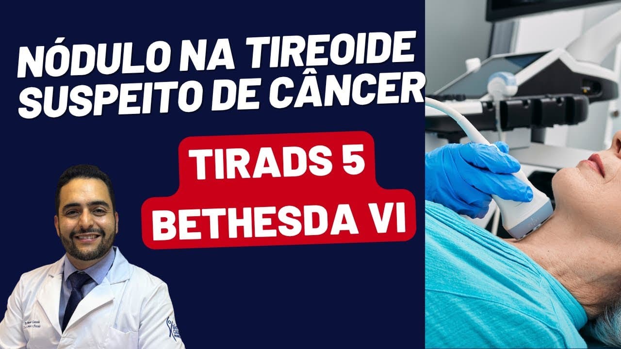 NÓDULO NA TIREOIDE = CÂNCER, COMO SABER? COMO TRATAR?