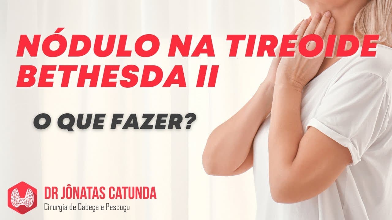 Bethesda II - nódulo na tireoide: O que fazer? Cirurgia? Acompanhar?