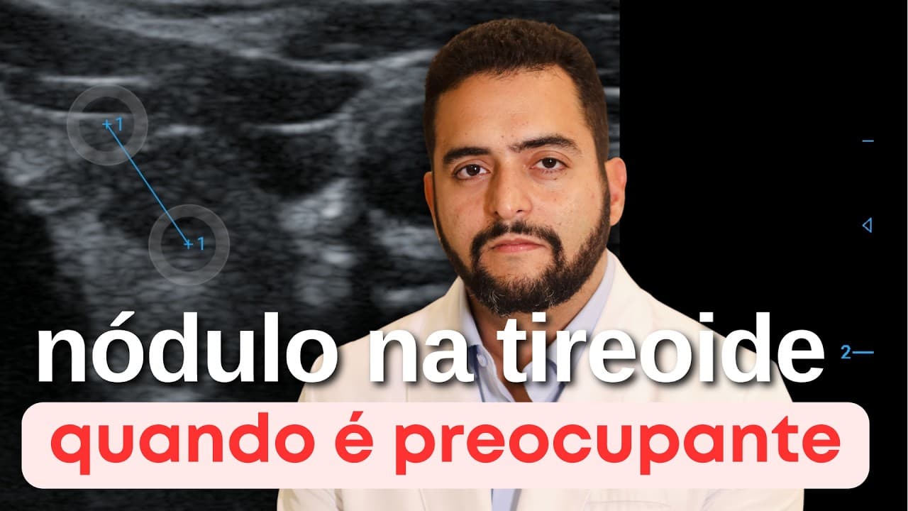 Descobriu um nódulo na tireoide? Quais fatores utilizo para decidir se deve acompanhar ou operar?