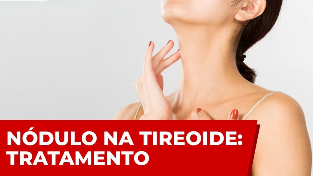 Tratamento do nódulo na tireoide - Cirurgia? Medicamentos? Acompanhar de quanto em quanto tempo?