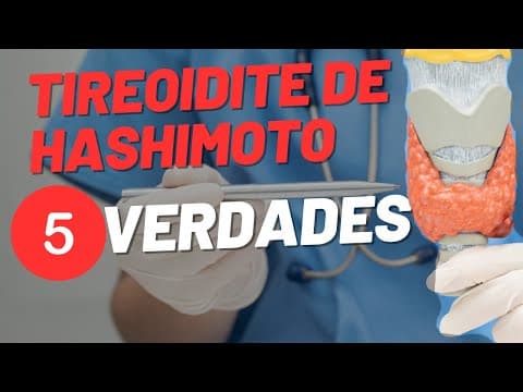 5 verdades sobre a Tireoidite de Hashimoto que todo paciente precisa saber