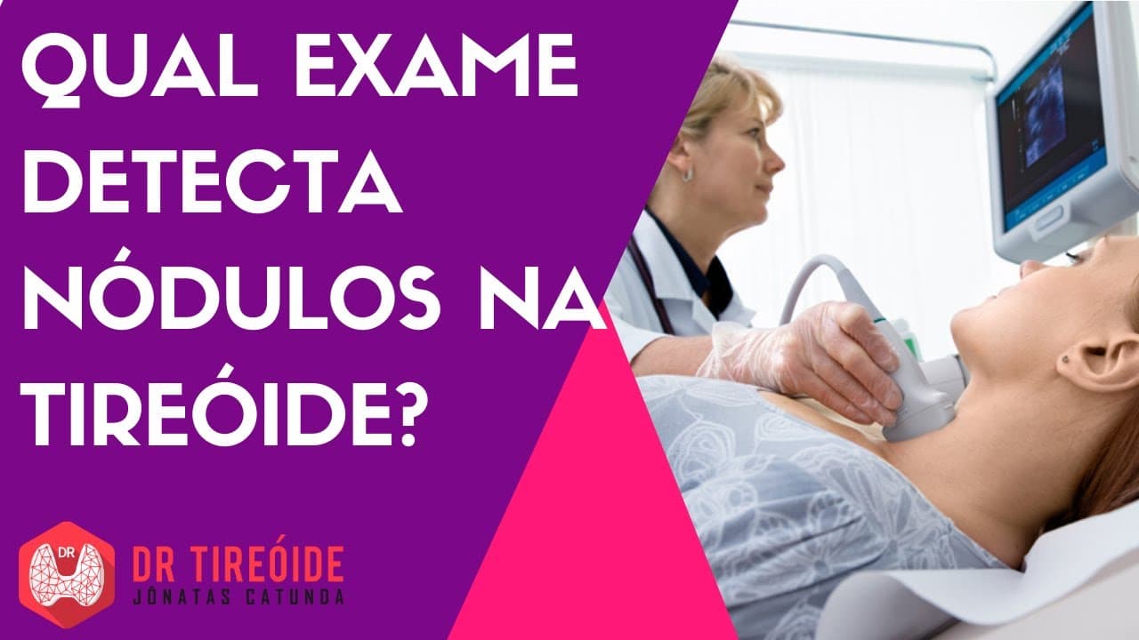 Qual exame detecta nódulo na tireóide? | Dr Jônatas Catunda