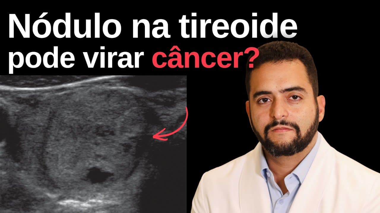 Nódulo na tireoide pode virar câncer?