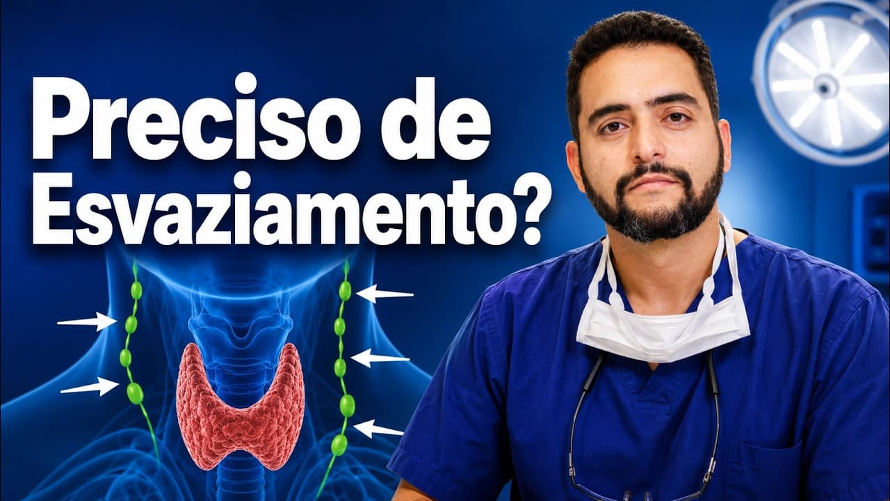 Esvaziamento Recorrencial: Quando Fazer no Câncer de Tireoide?