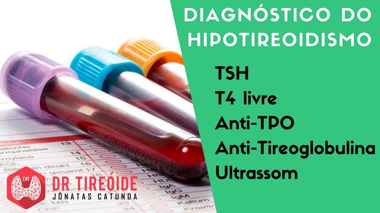 Diagnóstico do Hipotireoidismo - TSH alto? T4 livre baixo? | Dr Jônatas Catunda