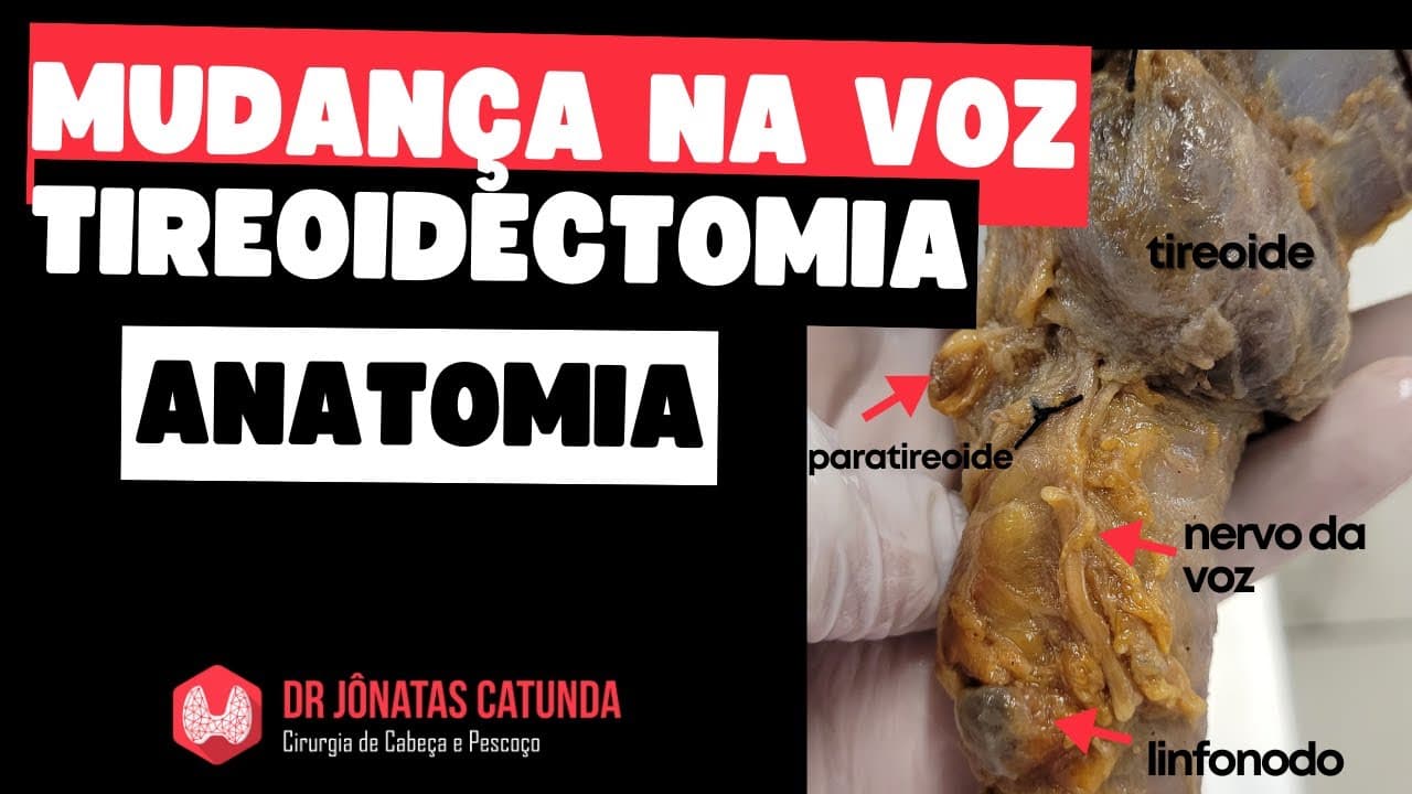 Cirurgia da tireoide pode causar alteração na voz, rouquidão, perder a voz?