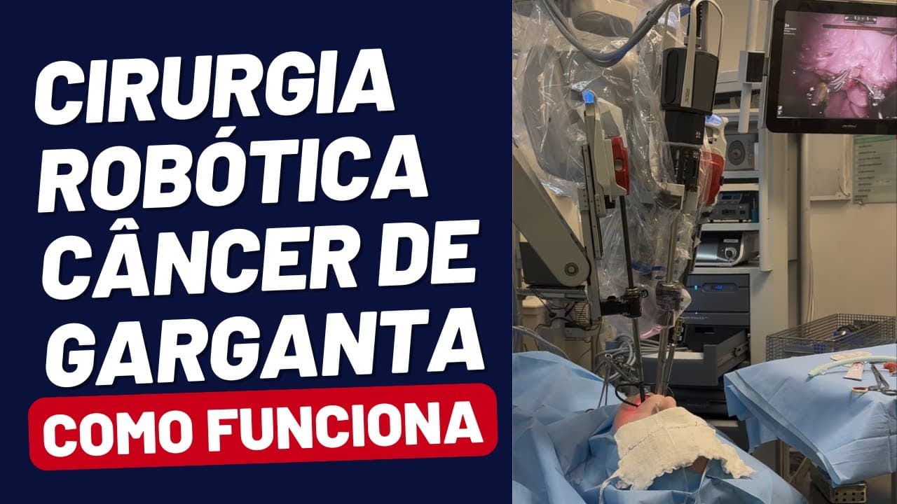 TRATAMENTO NOVO para o Câncer de GARGANTA - TORS - Cirurgia Robótica Transoral