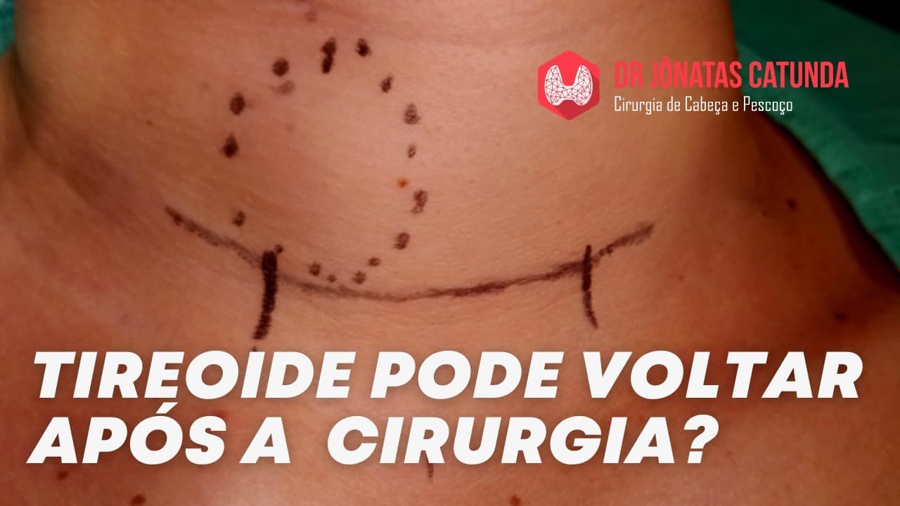 Tireóide pode voltar após a cirurgia?