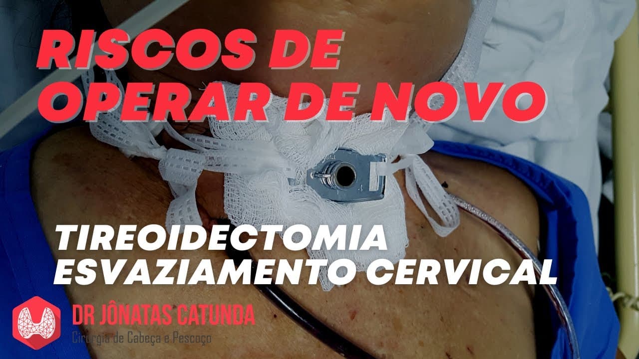 Quais os riscos quando precisa operar de novo o câncer de tireoide? Esvaziamento cervical