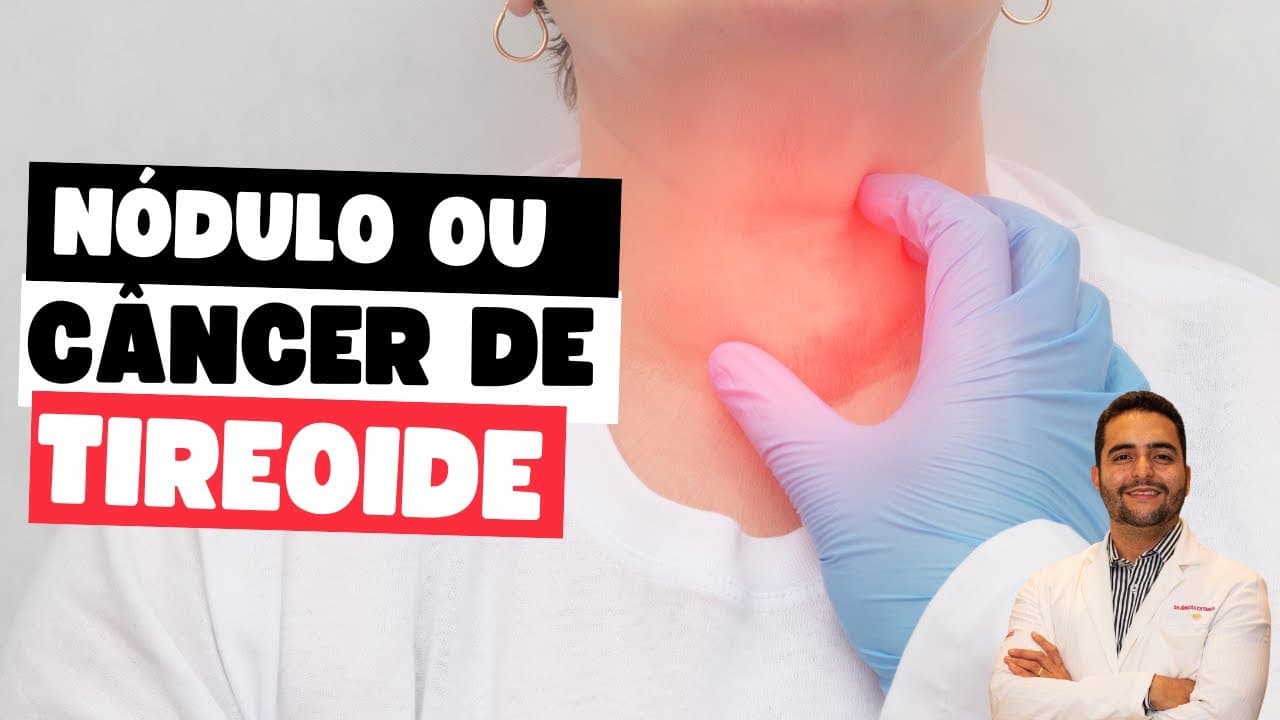 Risco do nódulo de tireoide ser um câncer de tireoide: o que você precisa saber