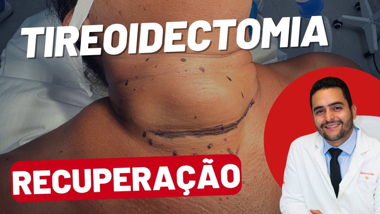 Tireoidectomia: O que Esperar Antes, Durante e Após a Cirurgia