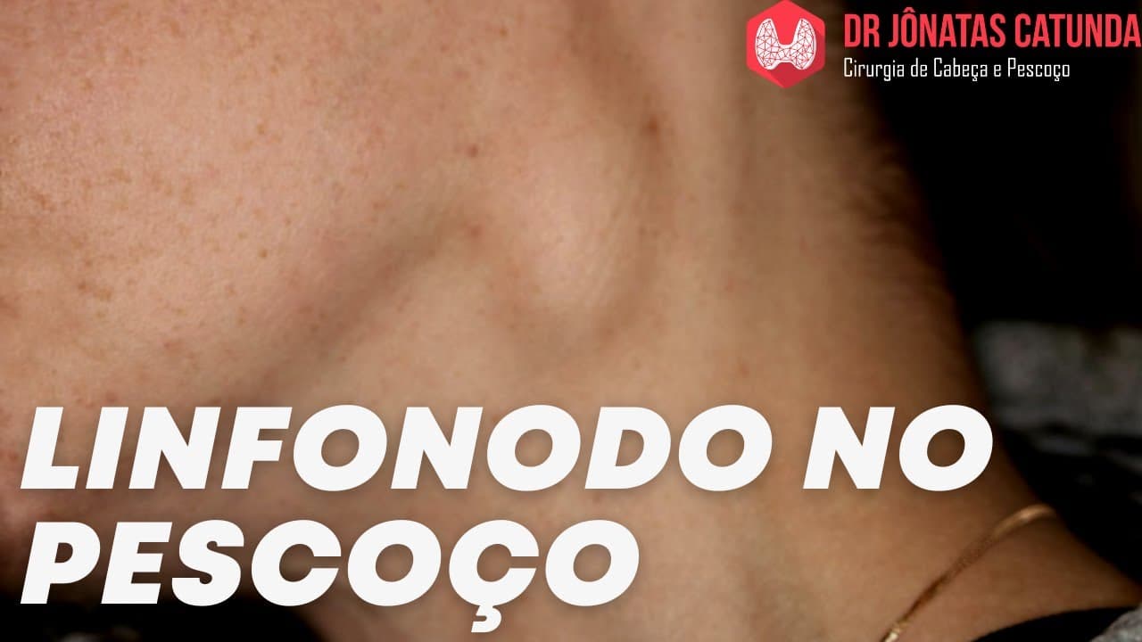 Linfonodo no pescoço que surgiu do nada