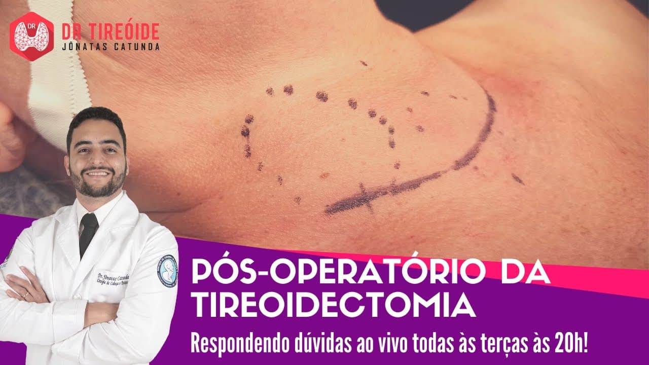 Pós-operatório da tireoidectomia total ou parcial - Dr Tireóide responde