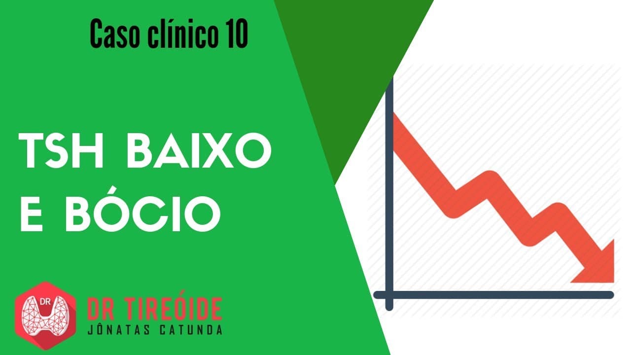 TSH baixo e bócio - Caso Clínico Dr Jônatas Catunda