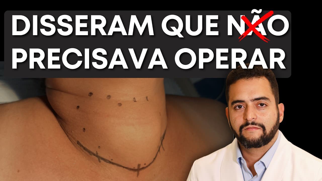 "Disseram que eu não precisava operar"