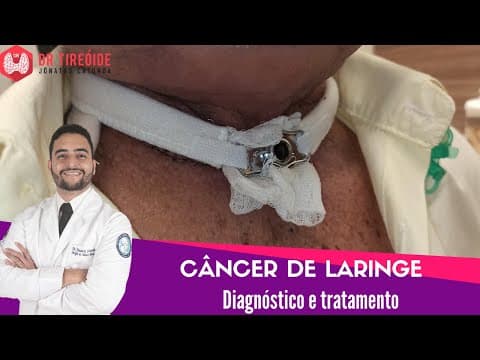 Câncer de laringe - Aula para a Disciplina de Cirurgia de cabeça e pescoço UFC