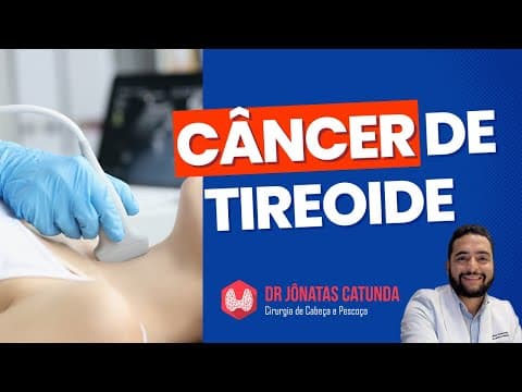 Câncer de Tireoide: Sintomas, Diagnóstico e Tratamento