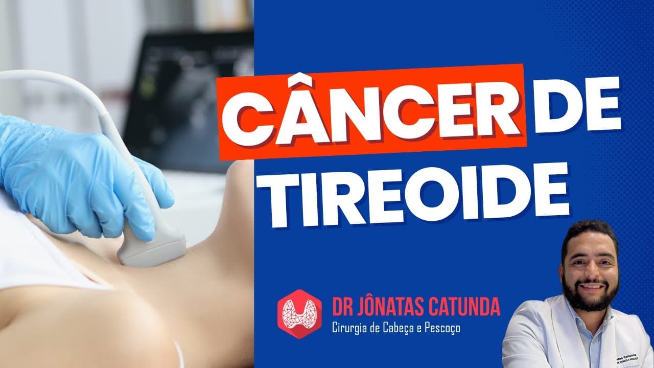 Câncer de Tireoide: Sintomas, Diagnóstico e Tratamento