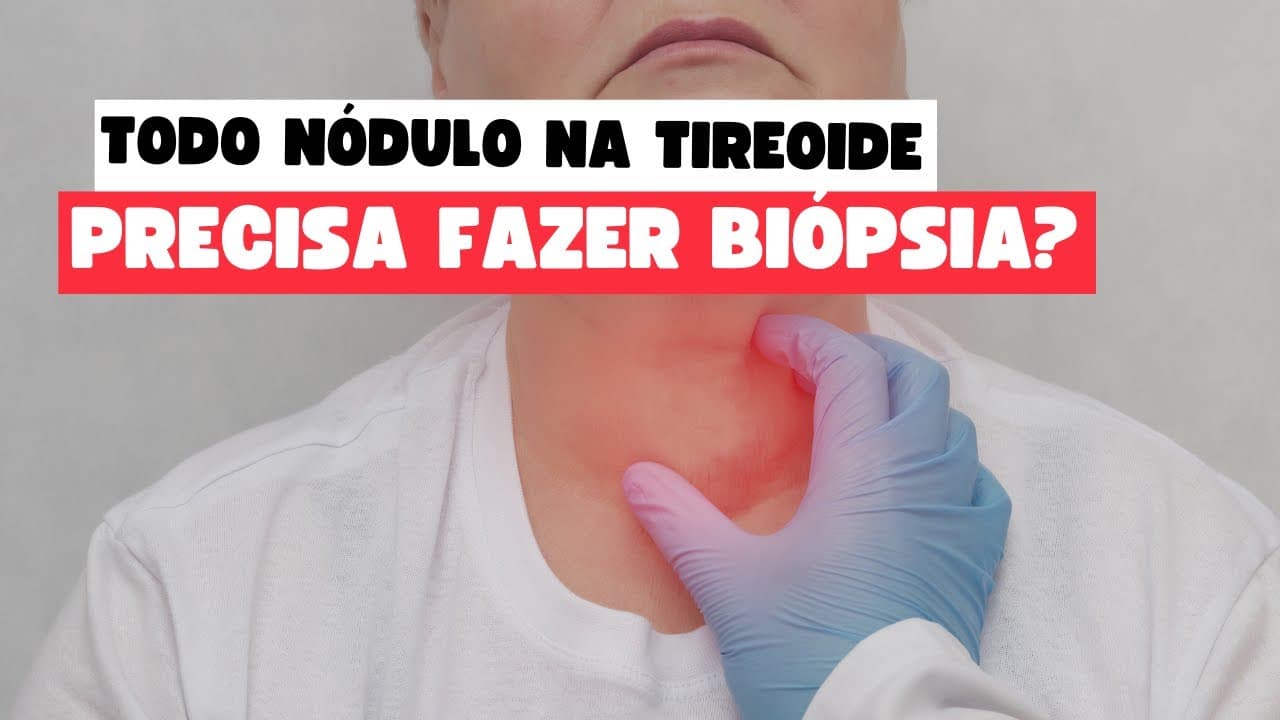 PAAF de Nódulo na Tireoide: Quando e Por Que Realizar esse Importante Exame