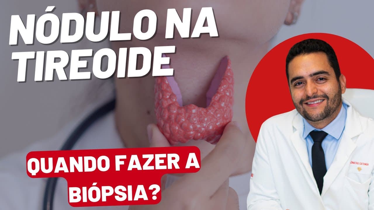 Nódulo na Tireoide: Quando Fazer a Biópsia e o que esperar
