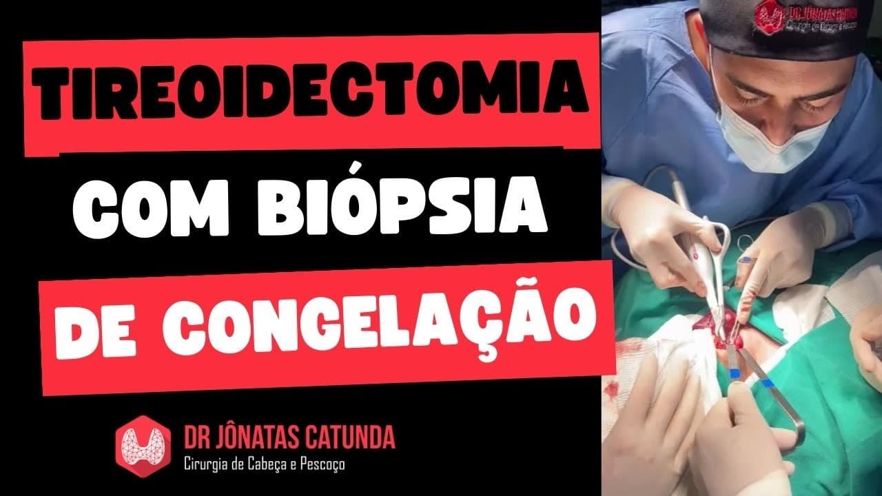 Tireoidectomia parcial com biópsia de congelação / Tireoidectomia total por Bethesda IV
