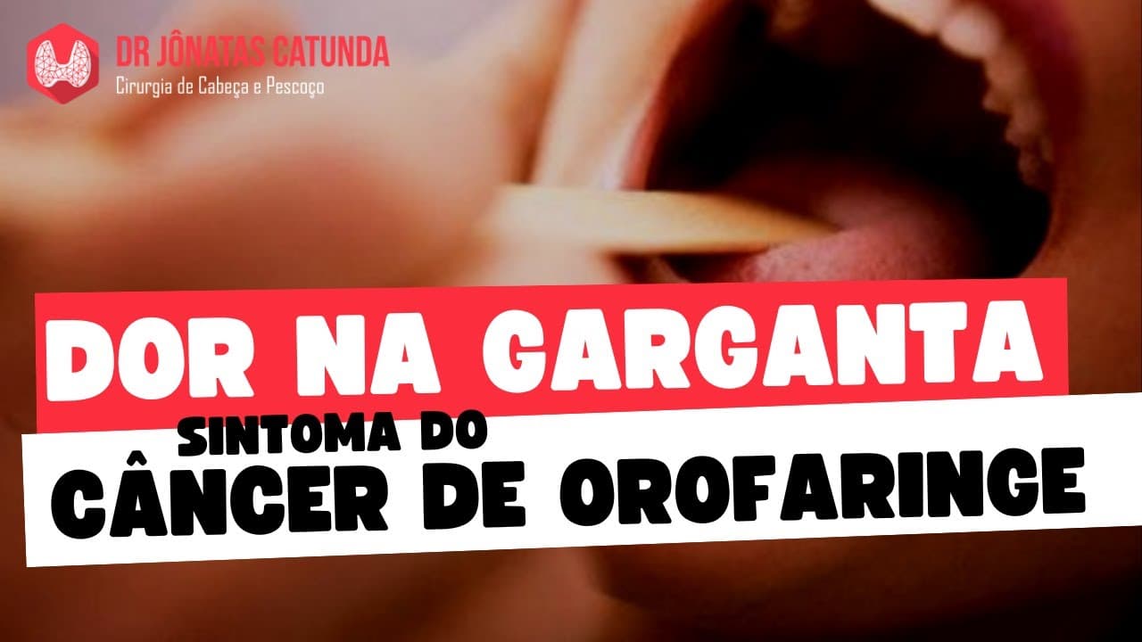 Câncer de garganta - sintomas (dor na garganta, dificuldade para engolir)