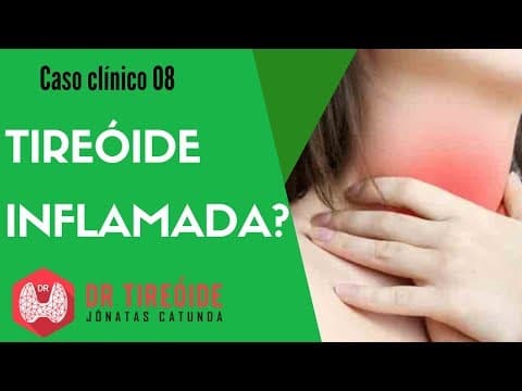 Tireóide inflamada? - Caso clínico | Dr Jônatas Catunda