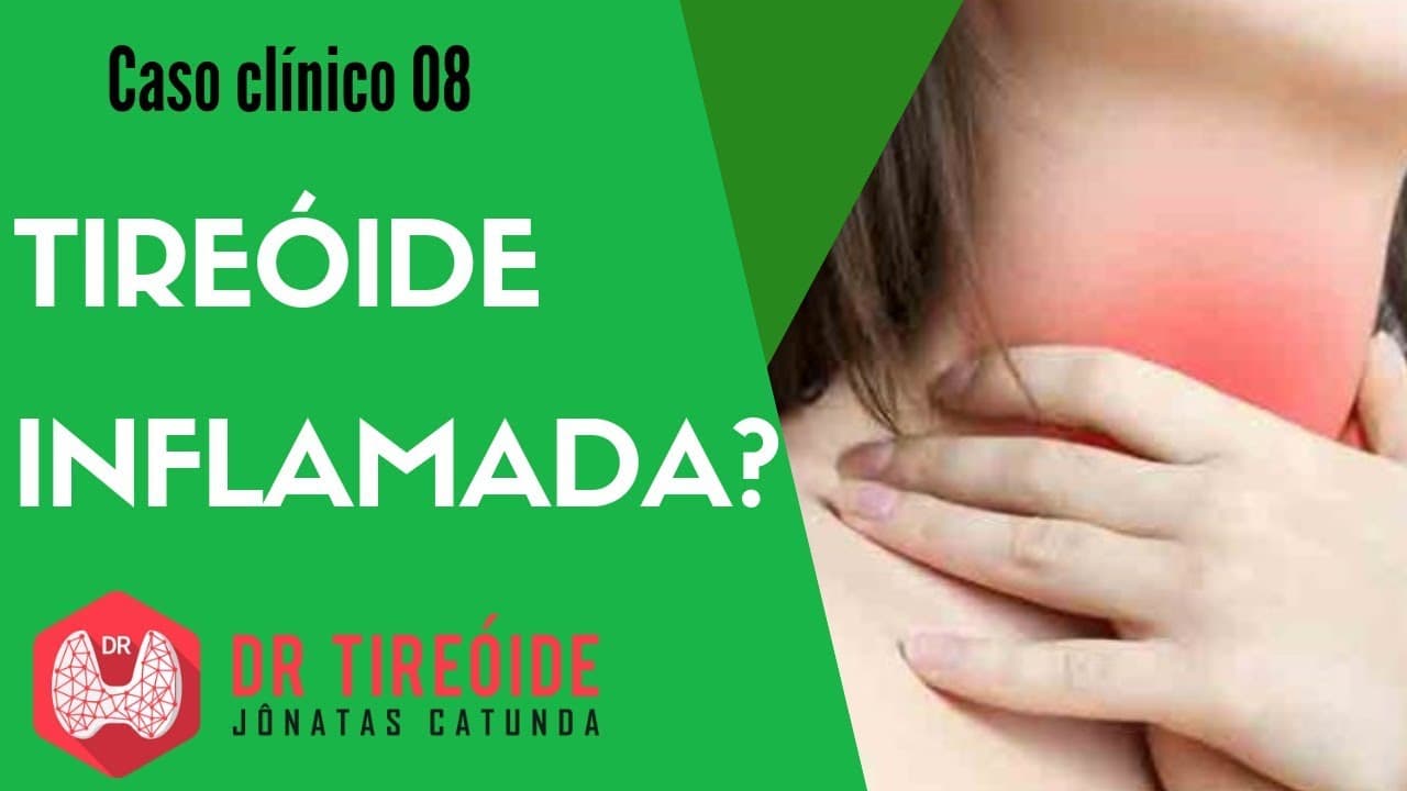 Tireóide inflamada? - Caso clínico | Dr Jônatas Catunda
