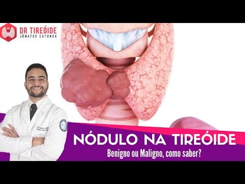 Nódulo na tireóide - maligno ou benigno, como saber? - Dr Tireóide responde