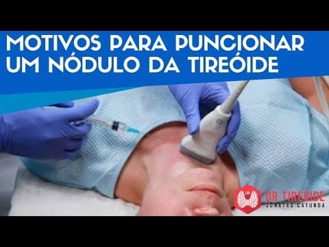 Motivos para puncionar um nódulo da tireóide - Dr Tireóide Responde