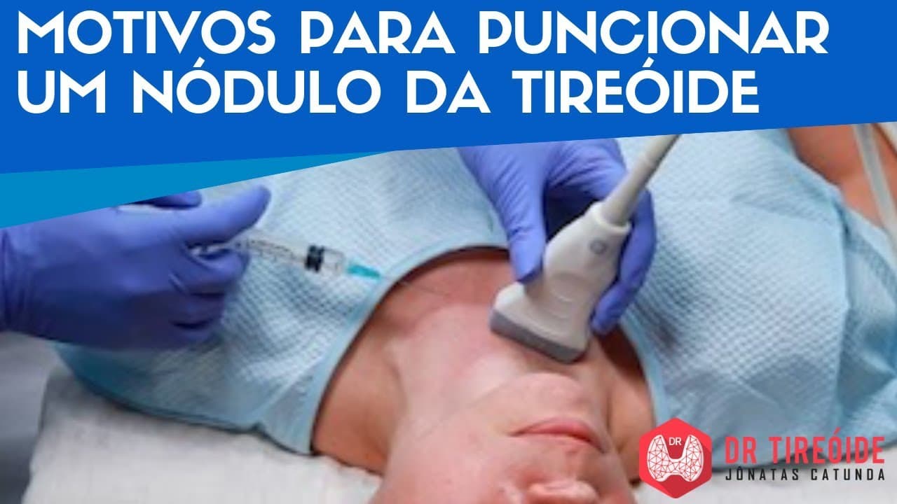 Motivos para puncionar um nódulo da tireóide - Dr Tireóide Responde