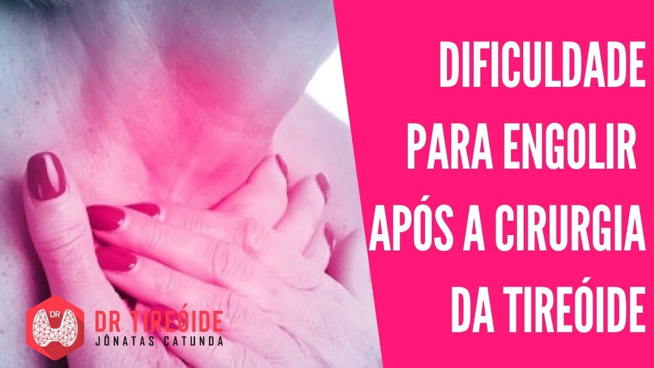 Dor ou dificuldade para engolir após a tireoidectomia | Dr Jônatas Catunda