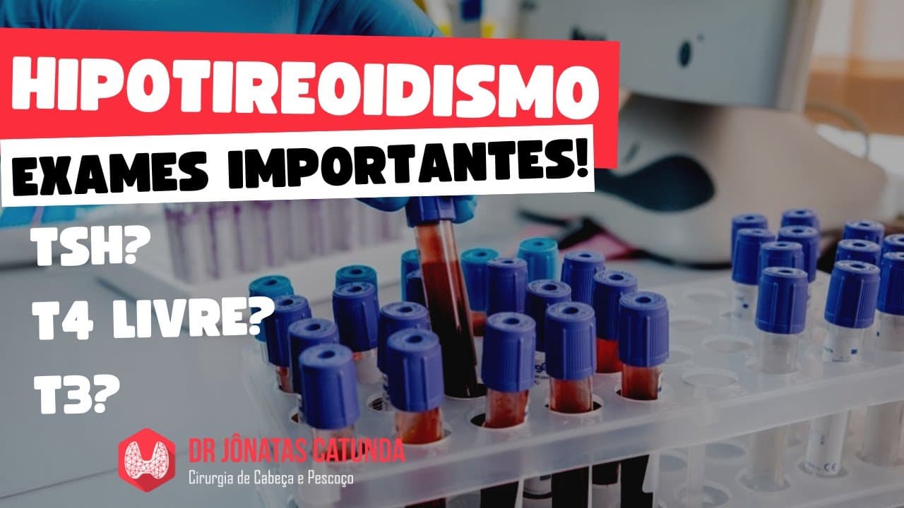 Exames importantes no Hipotireoidismo - TSH, T4 livre, T3, Anti-TPO, Anti-tireoglobulina...