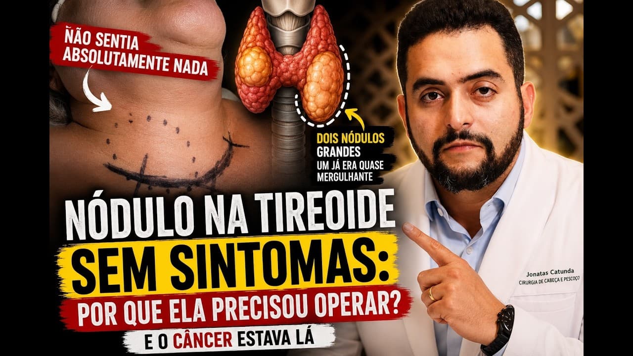 Nódulo na tireoide sem sintomas: por que ela precisou operar?